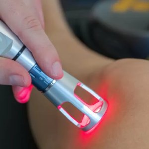 Laser Treatment | Physiotherapy On Wheels - Mississauga, Toronto, Brampton & the GTA
